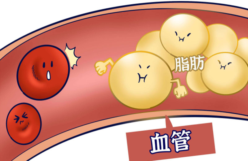 别让血脂“拖垮”你的血管！这篇科普讲透了 /